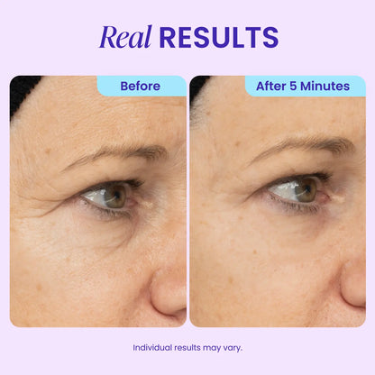 NEW! GOPURE Instant Lift Eye Gel - for the Look of Puffiness & Bags, Wrinkles, Fine Lines and Dark Circles, anti Aging Skin Care for Men & Women with Collagen Targeting Biotech under Eye Brightener